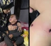 اسرائیلی فوج نے فلسطینی باپ کے سامنے 18 ماہ کے بچے کو سگریٹ سے داغ دیا