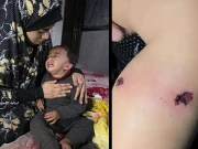 اسرائیلی فوج نے فلسطینی باپ کے سامنے 18 ماہ کے بچے کو سگریٹ سے داغ دیا