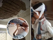 کراچی؛ سرکاری اسکول کی چھت کا پلستر گرنے سے کمسن طالب علم شدید زخمی