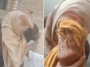 لاہور میں پولیو ٹیم پر حملہ، خاتون ورکر سر پر چوٹ لگنے سے زخمی