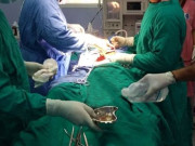 ہاتھوں میں کپکپاہٹ کے 2 مریضوں کو دماغ میں پیس میکر لگانے کی تیاری مکمل