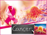 ’کینسر‘ مہلک مرض سے بچاؤ کے لیے انفرادی سے ریاستی سطح تک کیا اقدامات ضروری ہیں