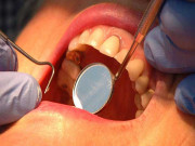 منہ کے کینسر میں پاکستان دنیا میں پہلے نمبر پر آگیا ،دیہی علاقوں کی خواتین بھی منہ کے کینسر میں مبتلا ،نوجوان مرض کا زیادہ شکار
