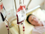 پاکستان میں 12 ہزار مریضوں کے بون میرو ٹرانسپلانٹ کیلیے صرف 11 فزیشن