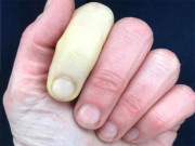 معروف برطانوی ٹی وی ہوسٹ کی انگلی زرد ہوگئی