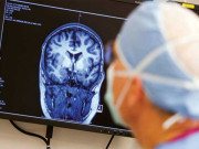 مرگی ایک دماغی مرض