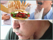 ’ ڈسفیجیا ‘ غذا نگلنے میں دشواری