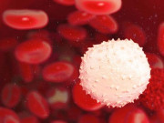 بلڈ کینسر میں خون کی تبدیلی سے نجات دلانے والی انقلابی جین تھراپی دریافت