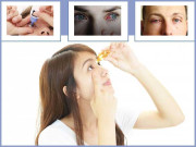 آشوبِ چشم گرمیوں کی شدت کے ساتھ جنم لینے والی بیماری