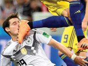 سوئیڈش پلیئر کا جوتا منہ پر لگ جانے سے جرمن فٹبالر روڈی کا چہرہ لہولہان ہوگیا