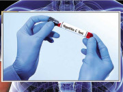 ہیپاٹائٹس۔۔۔۔ خاموش قاتل