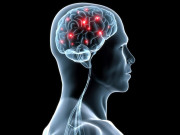 رعشے کی بیماری