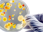 بیکٹریائی انفیکشن جو جان لیوا ثابت ہوسکتا ہے