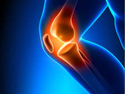 ملکی تاریخ میں پہلی بار بغیرآپریشن گھٹنوں کی بیماری کا علاج دریافت