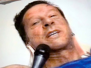 عمران خان لاہور میں لفٹر سے گر کر زخمی سرمیں شدید چوٹیں ملک بھر میں صحتیابی کی دعائیں