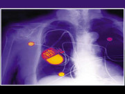 اعصاب ’’ہیک‘‘ ہوں گے  بیماری کا نیا علاج دریافت