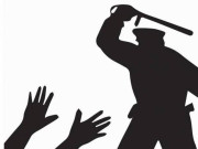 شہری پرتشدد 4 پولیس افسروں کیخلاف مقدمہ درج کرنے کا حکم