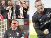 امریکن فٹبال کولاراڈو سے میچ میں وین رونی لہولہان میدان چھوڑنا پڑگیا