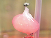 لیبارٹری میں گردہ اُگانے میں کامیابی حاصل کرلی گئی 