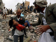 یمن میں سعودی اتحادی افواج کے حملے میں 22 بچے اور 4 خواتین جاں بحق