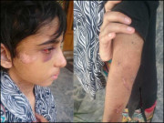 تشدد کا شکار بچی 11سالہ کنزا والد کو دینے کی استدعا مسترد