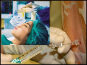 کیا اسپائنل اینیستھیزیا بہت سے مسائل کا سبب بن رہا ہے