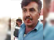 کراچی میں ٹریفک پولیس اہلکار کا ڈرائیور پر تشدد دانت توڑ دیئے