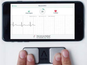 دل کی کیفیت معلوم کرنے کیلئے ای سی جی کی طرح مؤثر اسمارٹ فون ایپ ایجاد