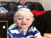  اینجل مینزسینڈروم اس کا شکارایک سالہ ریونابینا بھی ہےاورنیند سےمحروم بھی 