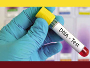 ڈی این اے ٹیسٹ نے نسل بدل دی