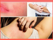 موسم سرما میں جلدی مسائل سے کیسے بچا جائے