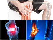 جوڑوں کا درد اسباب احتیاط اور علاج