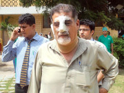 ڈاکٹر اور پیرا میڈیکل پر تشدد قابل مذمت ہے ڈاکٹر صغیر احمد