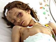 آسمان سے گری… جنگل میں اٹکی