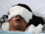 بھارتی فوج کی پیلٹ گولیوں سے ایک ہزار سے زائد کشمیریوں کی بینائی متاثر ہوئیں تحقیق