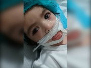 کمسن نشوہ کے دماغ کا بڑا حصہ متاثر ہے ڈاکٹرز