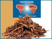 پروسٹیٹ گلینڈ کی سوزش سے بچاؤ کے فطری طریقے