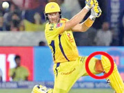 خون بہنے کے باوجود بیٹنگ شین واٹسن کو گھٹنے پر 6 ٹانکے لگوانے پڑگئے