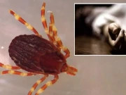 سندھ میں رواں سال کانگو وائرس سے پانچویں ہلاکت کی تصدیق