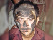 تھرپارکر میں انسانیت سوز واقعہ نوجوان پر وحشیانہ تشدد برہنہ اور منہ کالا کر کے گھمایا گیا