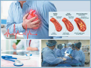 حرکت قلب بند ہونے لگے تو کیا کرنا چاہئے