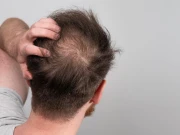 انرجی ڈرنکس بالوں کیلئے شدید نقصان دہ