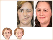 جب منہ ٹیڑھا ہوجائے تو…