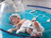 بھارت میں نالے میں پھینکی گئی نومولود بچی کو کتوں نے بچالیا ویڈیو وائرل