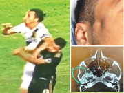 ابراہیمووچ پر حریف کھلاڑی کا جبڑا توڑنے پر پابندی عائد ہونے کا امکان