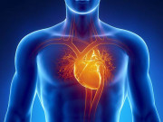 پاکستان میں پہلی بار’ فوکل کرائیوابلیشن‘ سے دل کے مرض کا کامیاب علاج