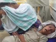 سگ گزیدگی کی ویکسین نہ ملنے پر بچے کی ہلاکت