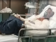 گوجرانوالہ میں لڑکی نے لڑکے کو تیل چھڑک کر آگ لگادی