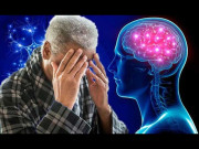 ڈیمنشیا یاداشت کی کمی کی بیماری