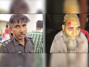 کراچی میں کتے نے بچے خواتین پولیس افسر سمیت 18 افراد کو کاٹ لیا